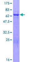 Human ZNF783 Protein (Recombinant GST)