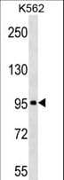 TARSH / ABI3BP Antibody (aa648-675)