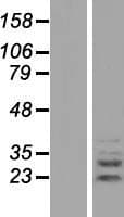 PLEKHF2 Protein (Over-Expression Lysate Myc-DDK (Flag))