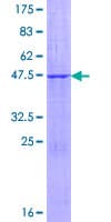 Human FBXO36 / F-Box Protein 36 (Recombinant GST)