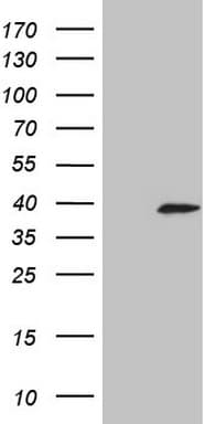 KLK3 / PSA Antibody (aa25-261, clone OTI2G8)
