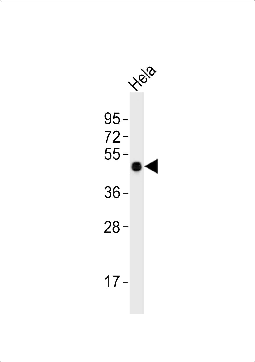 TUSC3 Antibody