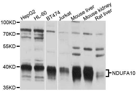 NDUFA10 Antibody