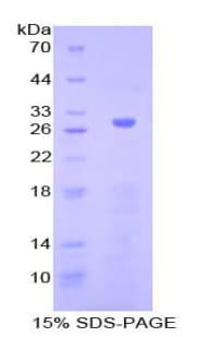 Human ADCY5 / Adenylate Cyclase 5 Protein (Recombinant 6His, N-terminus)