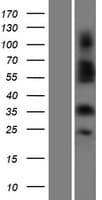 Human OR4C3 Protein (Over-Expression Lysate Myc-DDK (Flag))