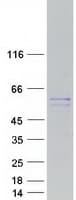 Human MIPOL1 Protein (Recombinant Myc-DDK (Flag))