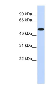 PDK2 Antibody (aa251-300)