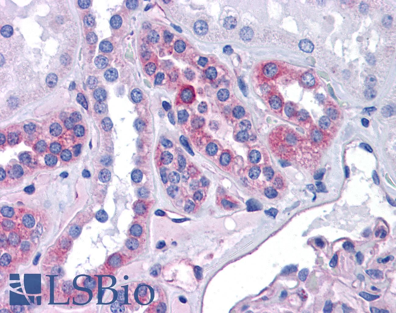 CCL2 / MCP1 Antibody (C-Terminus)