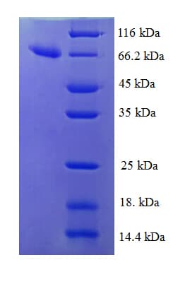 Human IDH3B Protein (Recombinant GST)