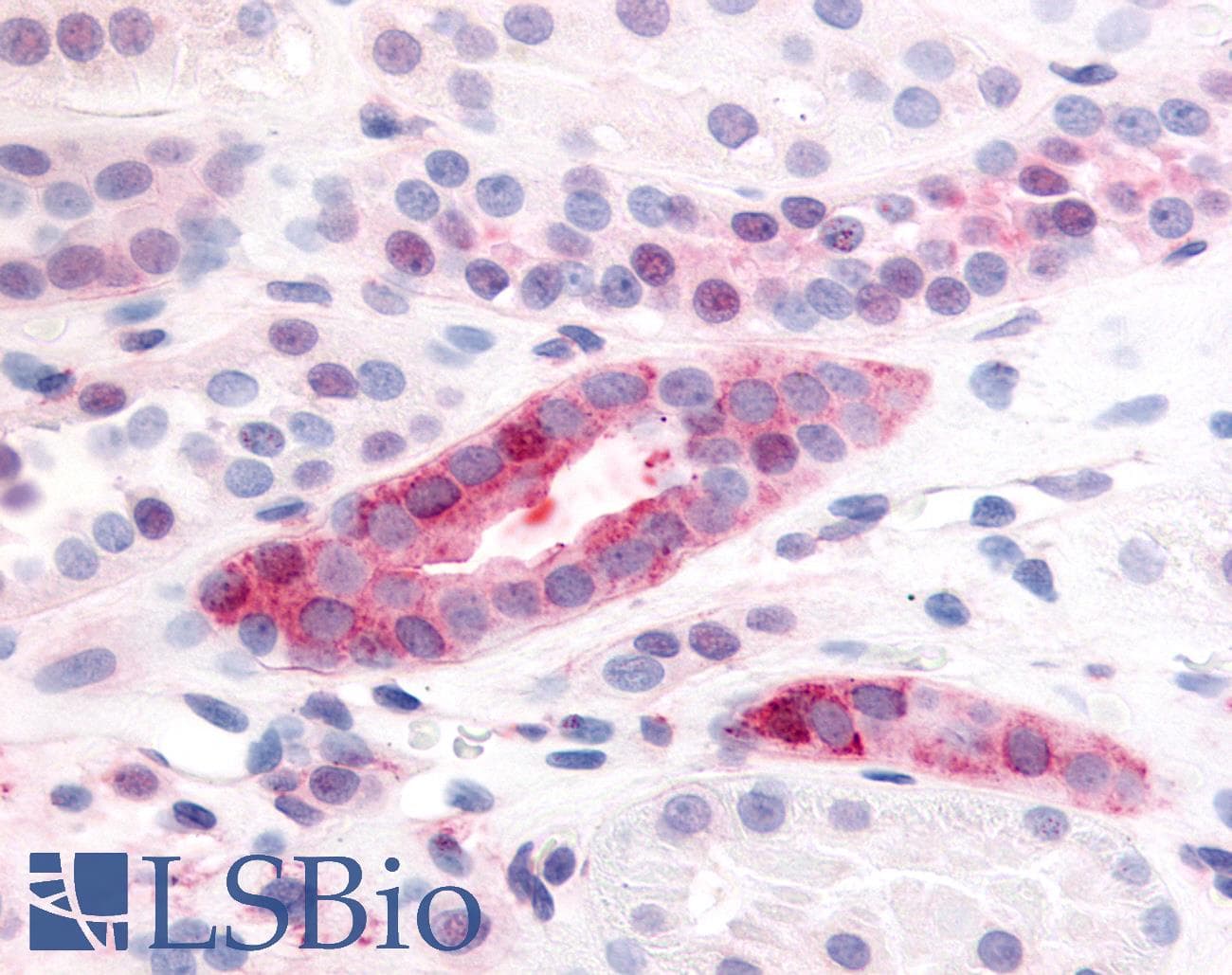 IHC-plus™ PDGFRB / PDGFR Beta Antibody (Extracellular Domain)