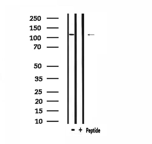 ZC3H7B Antibody