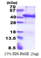 Human USF1 / USF Protein (Recombinant His)