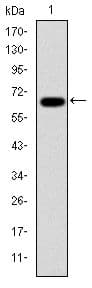 PSMB8 / LMP7 Antibody (clone 1A5)