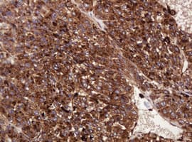 ATP6V1B2 Antibody (clone 1.00E+11, Carrier-free)