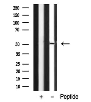 STK38 Antibody