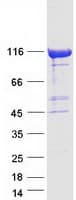 Human CHD1L Protein (Recombinant Myc-DDK (Flag))