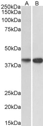 IHC-plus™ EXOG / ENDOGL1 Antibody