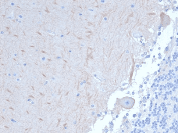 APG5 / ATG5 Antibody (clone ATG5/2101)