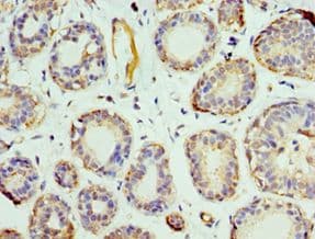 Polyclonal Rabbit anti-Human Prohibitin 2 / PHB2 Antibody (aa1-299, IHC, WB)