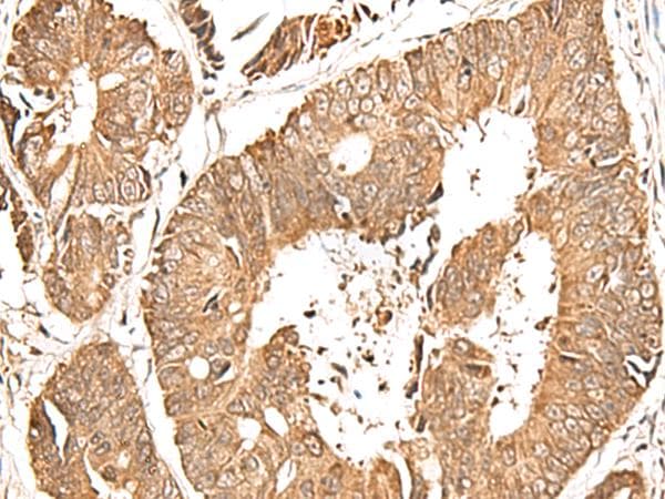 GFI1 Antibody