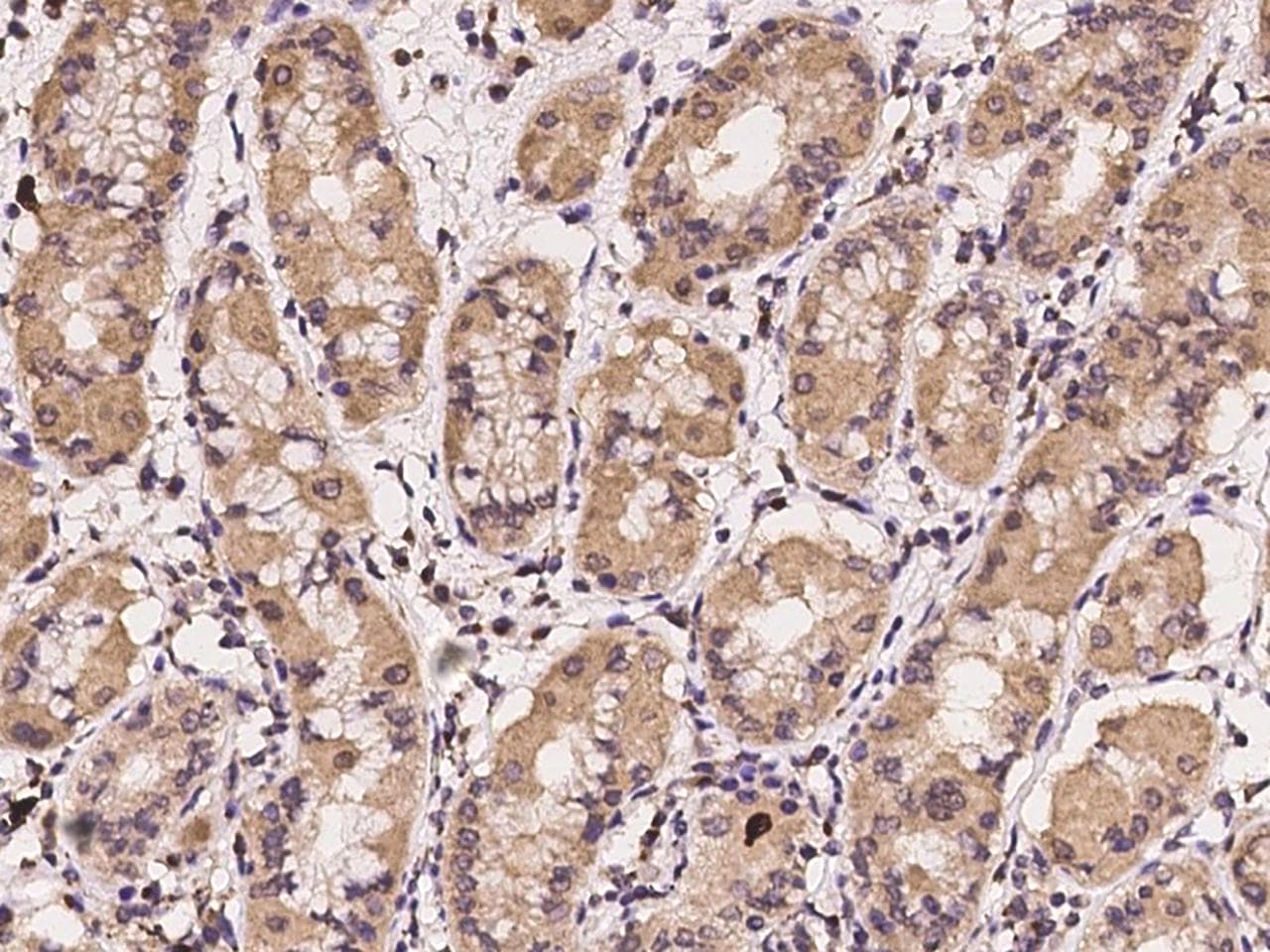 Polyclonal Rabbit anti-Human CHST12 Antibody (IHC)