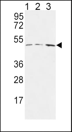 Polyclonal Rabbit anti-Human HAPLN1 Antibody (aa10-38, IHC, WB)