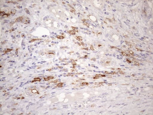 Monoclonal Mouse anti-Human CPM / Carboxypeptidase M Antibody (clone OTI7C1, aa124-423, IHC, WB)