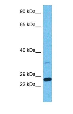 BOK Antibody (N-Terminus)