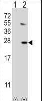 Polyclonal Rabbit anti-Human UBE2G1 Antibody (aa1-30, IHC, WB)