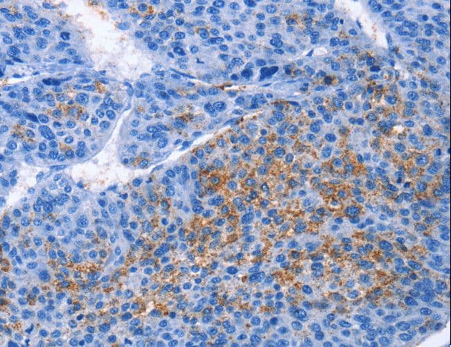 CXCL3 / GRO Gamma Antibody