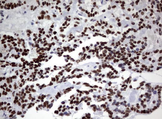 ZSCAN18 / ZNF447 Antibody (clone UMAB113, Carrier-free)