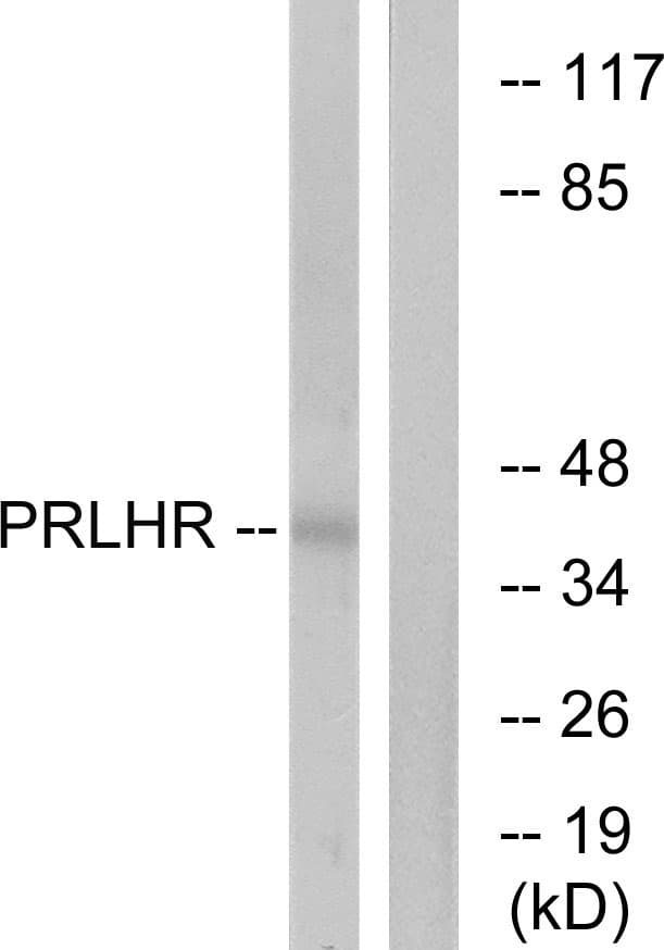 PRLHR / GPR10 Antibody (aa184-233)