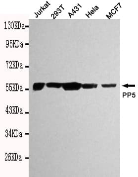 Monoclonal Mouse anti-Human PPP5C Antibody (WB)