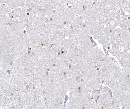 AHR Antibody (phospho-Ser36)