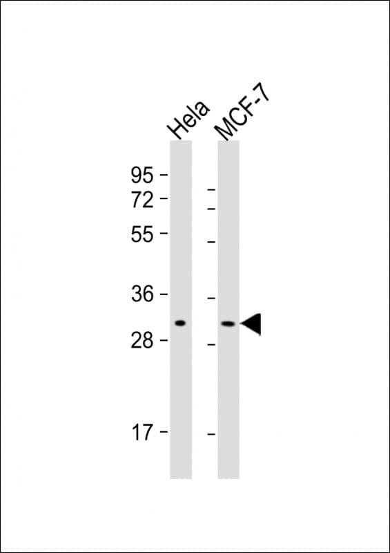 RAB20 Antibody (clone 1694CT210.218.54)