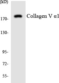Polyclonal Rabbit anti-Human COL5A1 / Collagen V Alpha 1 Antibody (aa276-325, IHC, WB)