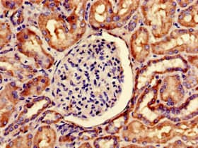 Polyclonal Rabbit anti-Human SNRPD1 / SMD1 Antibody
