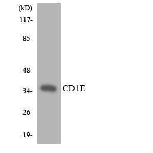 CD1E Antibody (aa199-248)