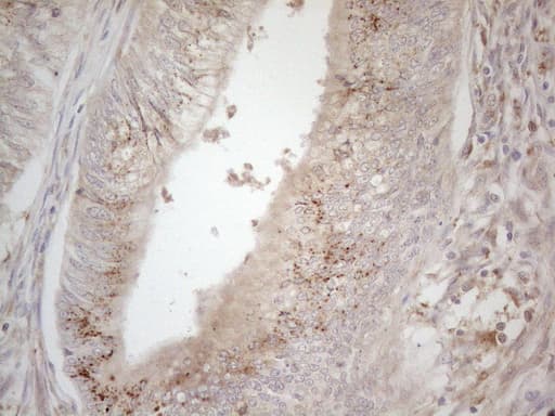 TNFRSF10B / Killer / DR5 Antibody (aa203-411, clone OTI2A5)