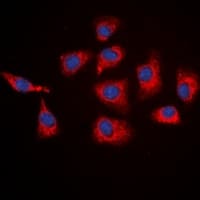 SGK1 / SGK Antibody (C-Terminus)