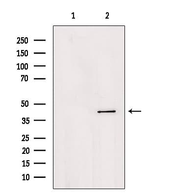 Polyclonal Rabbit anti-Human AGPAT4 Antibody (IF, WB)