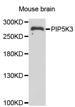 PIKFYVE / PIP5K Antibody