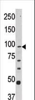 CPT1A Antibody (aa606-636)