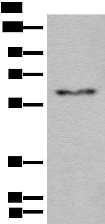 Polyclonal Rabbit anti-Human CES2 / Esterase Antibody (IHC, WB)
