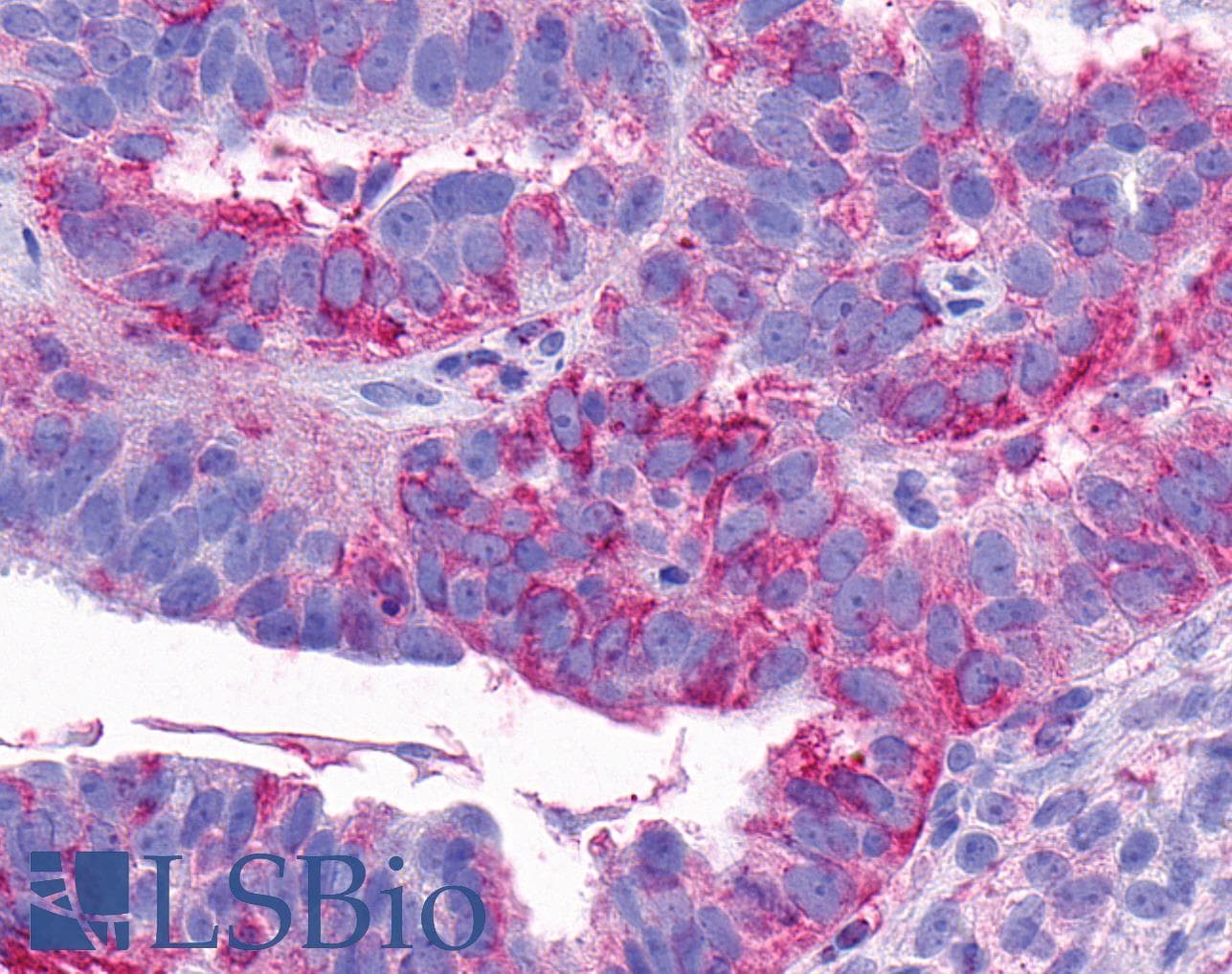PathPlus™ Polyclonal Rabbit anti-Human NTSR2 / NTR2 Antibody (C-Terminus, IHC)