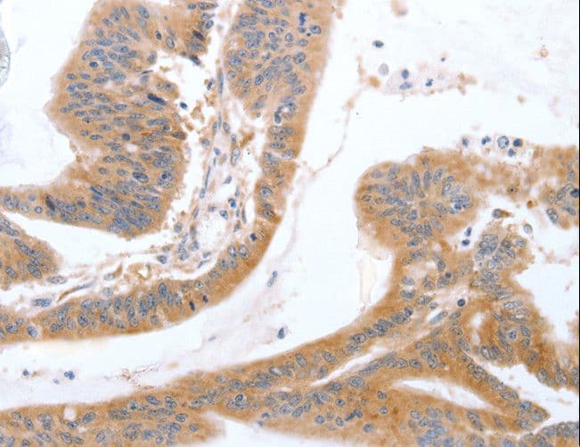Polyclonal Rabbit anti-Human TGFA / TGF Alpha Antibody (IHC)