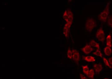 STMN4 / RB3 Antibody