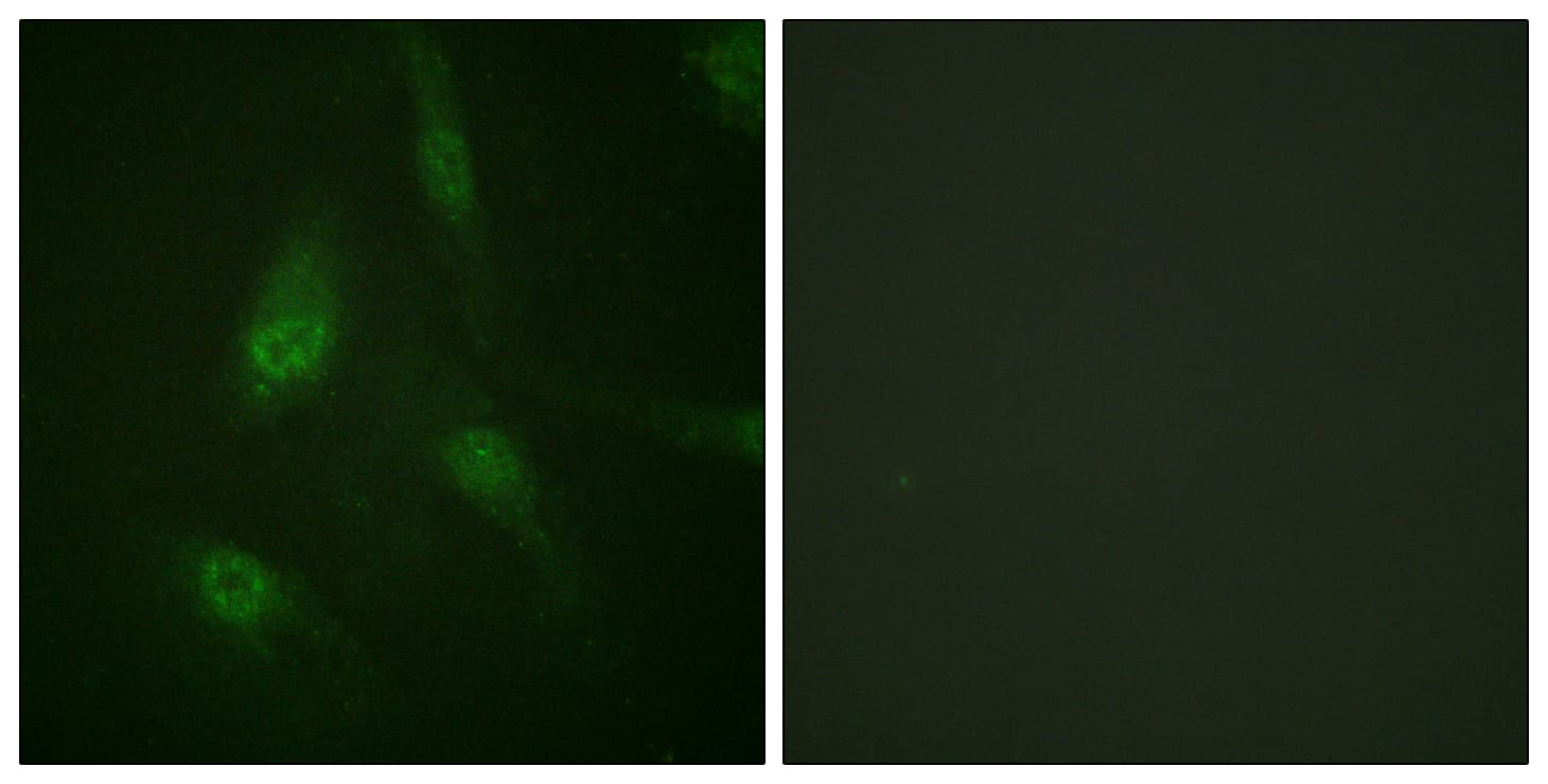 NFAT4 / NFATC3 Antibody (phospho-Ser165)