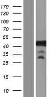 GLI4 Protein (Over-Expression Lysate Myc-DDK (Flag))
