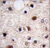 KDM6B / JMJD3 Antibody (aa1-30)